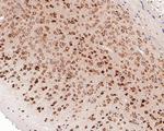 eIF4E Antibody in Immunohistochemistry (Paraffin) (IHC (P))