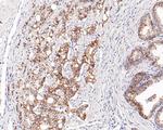 delta Catenin Antibody in Immunohistochemistry (Paraffin) (IHC (P))