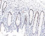 FOXP1 Antibody in Immunohistochemistry (Paraffin) (IHC (P))