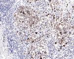 MAGE1 Antibody in Immunohistochemistry (Paraffin) (IHC (P))