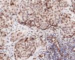 FBXW7 Antibody in Immunohistochemistry (Paraffin) (IHC (P))