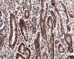 FBXW7 Antibody in Immunohistochemistry (Paraffin) (IHC (P))