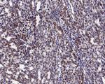 FBXW7 Antibody in Immunohistochemistry (Paraffin) (IHC (P))