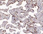 SLC34A2 Antibody in Immunohistochemistry (Paraffin) (IHC (P))