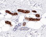 Mammaglobin A Antibody in Immunohistochemistry (Paraffin) (IHC (P))