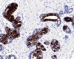 Mammaglobin A Antibody in Immunohistochemistry (Paraffin) (IHC (P))