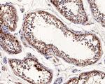 CTAG1B Antibody in Immunohistochemistry (Paraffin) (IHC (P))