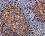 TCL1A Antibody in Immunohistochemistry (Paraffin) (IHC (P))