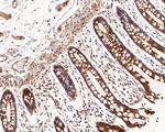 RALA Antibody in Immunohistochemistry (Paraffin) (IHC (P))