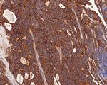 RALA Antibody in Immunohistochemistry (Paraffin) (IHC (P))