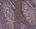 CD43 Antibody in Immunohistochemistry (Paraffin) (IHC (P))