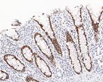 SATB2 Antibody in Immunohistochemistry (Paraffin) (IHC (P))