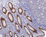 SATB2 Antibody in Immunohistochemistry (Paraffin) (IHC (P))