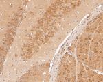 Kir2.1 (KCNJ2) Antibody in Immunohistochemistry (Paraffin) (IHC (P))