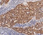 SMAD4 Antibody in Immunocytochemistry (ICC/IF)