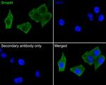 SMAD4 Antibody in Immunohistochemistry (Paraffin) (IHC (P))