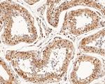 SMAD4 Antibody in Immunohistochemistry (Paraffin) (IHC (P))