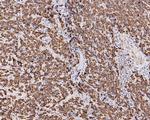 Bcl-2 Antibody in Immunohistochemistry (Paraffin) (IHC (P))