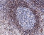 Bcl-2 Antibody in Immunohistochemistry (Paraffin) (IHC (P))