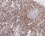 Bcl-2 Antibody in Immunohistochemistry (Paraffin) (IHC (P))