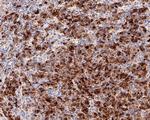 AFP Antibody in Immunohistochemistry (Paraffin) (IHC (P))