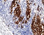 SOX10 Antibody in Immunohistochemistry (Paraffin) (IHC (P))