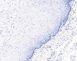 SOX10 Antibody in Immunohistochemistry (Paraffin) (IHC (P))