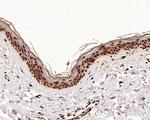 H4K8ac Antibody in Immunohistochemistry (Paraffin) (IHC (P))