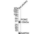 POMC Antibody in Western Blot (WB)