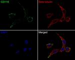 CD116 Antibody in Immunocytochemistry (ICC/IF)