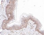 CD116 Antibody in Immunohistochemistry (Paraffin) (IHC (P))