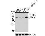 CD116 Antibody in Western Blot (WB)