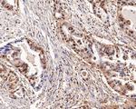 PSME2 Antibody in Immunohistochemistry (Paraffin) (IHC (P))