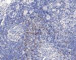 CTLA-4 Antibody in Immunohistochemistry (Paraffin) (IHC (P))