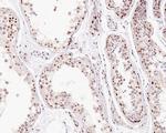 TRF2 Antibody in Immunohistochemistry (Paraffin) (IHC (P))