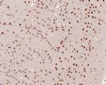 PSMC5 Antibody in Immunohistochemistry (Paraffin) (IHC (P))