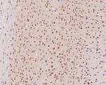 PSMC5 Antibody in Immunohistochemistry (Paraffin) (IHC (P))