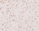 YTHDF1 Antibody in Immunohistochemistry (Paraffin) (IHC (P))