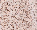 YTHDF1 Antibody in Immunohistochemistry (Paraffin) (IHC (P))