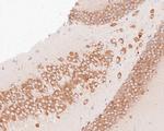 YTHDF1 Antibody in Immunohistochemistry (Paraffin) (IHC (P))