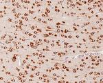 YTHDF1 Antibody in Immunohistochemistry (Paraffin) (IHC (P))