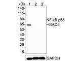 NFkB p65 Antibody in Western Blot (WB)