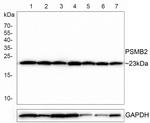 PSMB2 Antibody in Western Blot (WB)