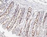 G3BP1 Antibody in Immunohistochemistry (Paraffin) (IHC (P))