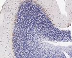 G3BP1 Antibody in Immunohistochemistry (Paraffin) (IHC (P))