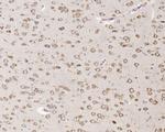 EBP1 Antibody in Immunohistochemistry (Paraffin) (IHC (P))