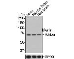 NF2 Antibody in Western Blot (WB)