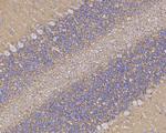 GLT-1 Antibody in Immunohistochemistry (Paraffin) (IHC (P))