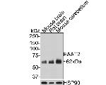 GLT-1 Antibody in Western Blot (WB)