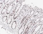 MLH1 Antibody in Immunohistochemistry (Paraffin) (IHC (P))